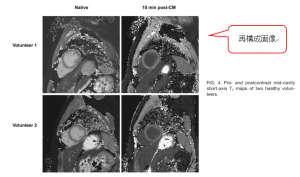 図6　再構成画像　　 文献[3]　より改変引用
